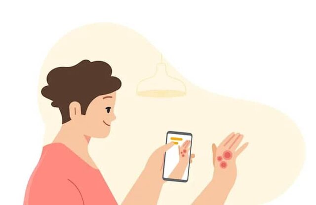 شناسایی بیماری‌های شایع پوست و تشخیص “سل” توسط هوش مصنوعی جدید گوگل