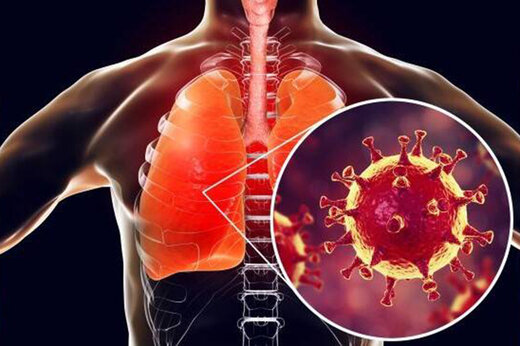 محافظت از ضعیف‌ترین عضو بدن در مقابل طوفان کرونا