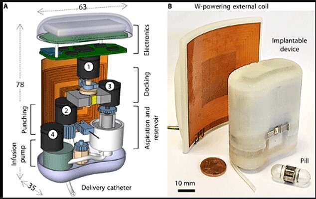 پمپ انسولینی که درون بدن قرار می‌گیرد و با کپسول خوراکی شارژ می‌شود!