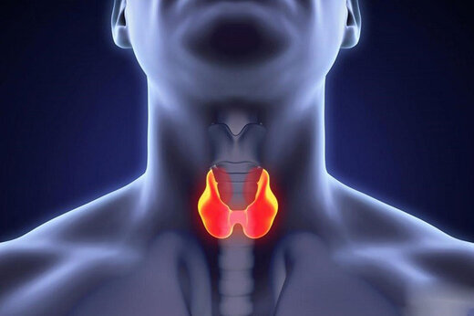 درمان‌های طبیعی کم کاری تیروئید را بشناسید