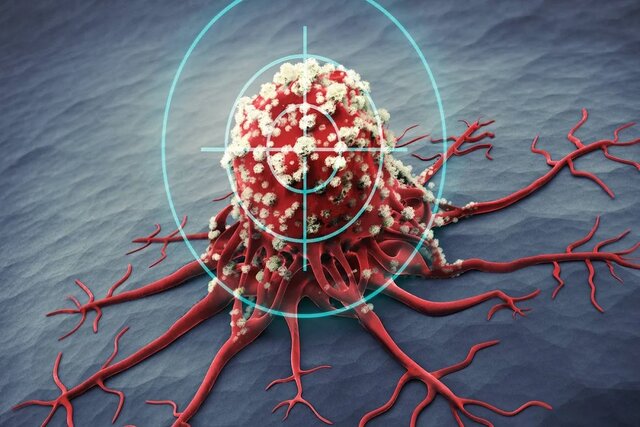 انفجار تومور سرطانی با نانوحباب‌هایی ۲۵۰۰ برابر کوچک‌تر از دانه نمک