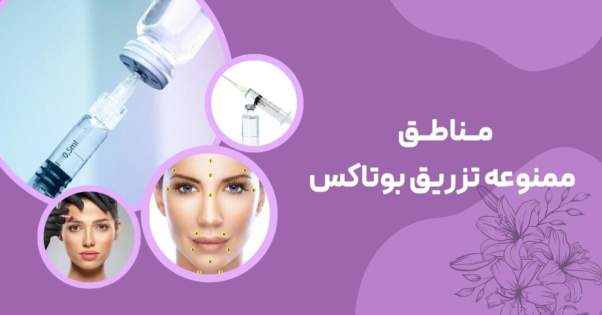 مناطق ممنوعه تزریق بوتاکس + 7 تا از خطرناک ترین ها