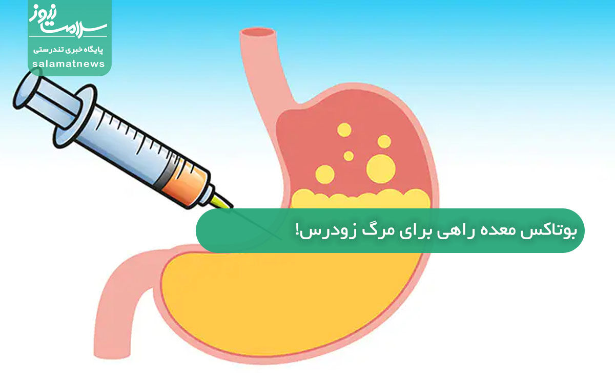 بوتاکس معده راهی برای مرگ زودرس!