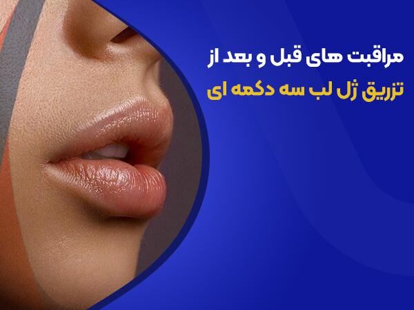 آموزش ژل لب سه دکمه ای بهمراه بررسی مزایا و عوارض