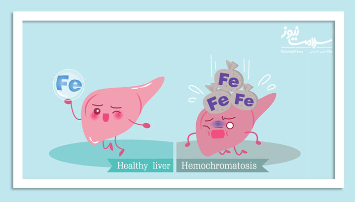 هموکروماتوز یا اضافه بار آهن: علائم، تشخیص و روش درمانی