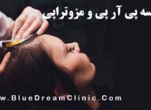 فرق بین مزوتراپی و پی آر پی مو؛ کدام روش برای جلوگیری از ریزش مو بهتر است؟