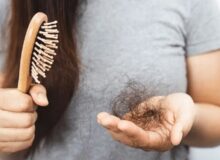 تفاوت ریزش مو در زنان و مردان | ۳ نکته در ریزش موی مردان
