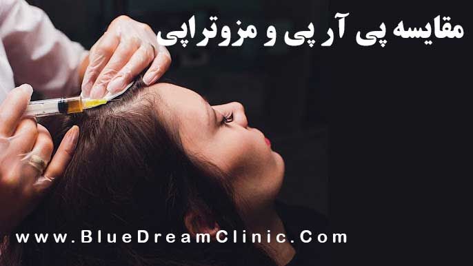 فرق بین مزوتراپی و پی آر پی مو؛ کدام روش برای جلوگیری از ریزش مو بهتر است؟