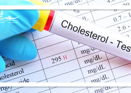 علت کلسترول بالا در افراد لاغر